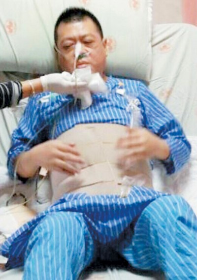 孙德荣自爆摘除下体,为止痛吸毒。