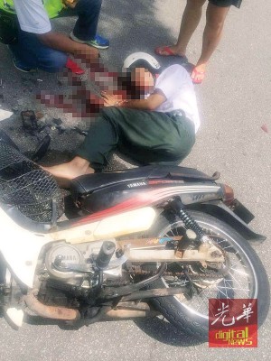 中学生骑士遭后镜玻璃割伤脸部,血流满面。
