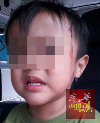 死者受伤的小孩,一度让送往国大医院接受治疗。