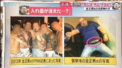 《富士电视台》日前播放两张照片对比，质疑金正男身上的刺青消失（档案照）。