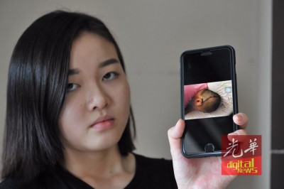 黄迈潼朝媒体展示父亲的伤势。