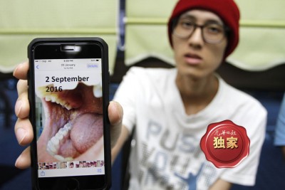 医院给他2个治病方案,一是继续化疗,二是通过药物来控制病情,随时要有面对死亡的准备。