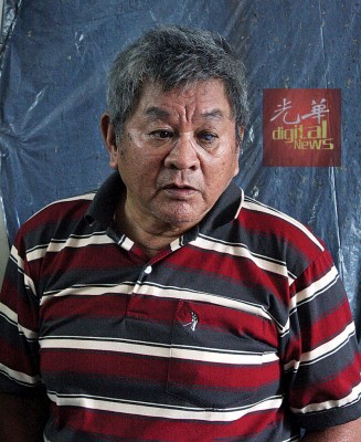柯亚兴左眼因白内障而失明。