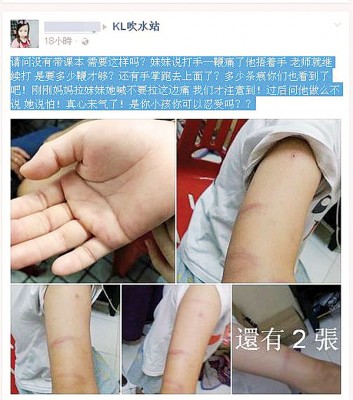 7月,一名三年级学生因忘记带课本,被老师鞭打双臂。
