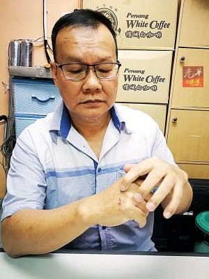 车主陈锦安手背被玻璃碎片割伤。