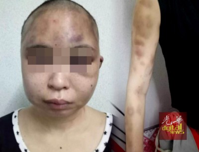 家庭主婦被丈夫懷疑不貞,慘遭暴打,頭髮也被剃光,(圖由警方提供)