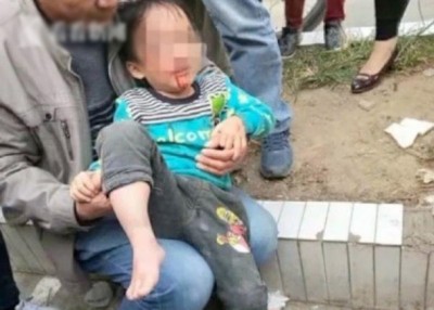 男童被撞到口里流血。