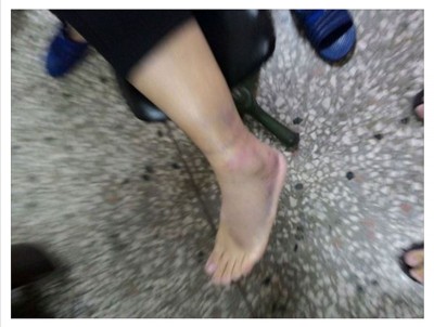 其中一帖文是死者在去年12月一次比赛中扭伤脚的照片。