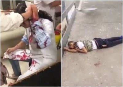女医生(左)头部受伤,其他医护人员即场为她急救,涉案男子(右)则爬窗坠亡。
