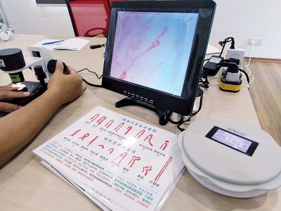 除防辐射外,刘德福和团队研发的消除器也可促进血液循环,找到一个创新的新方向。