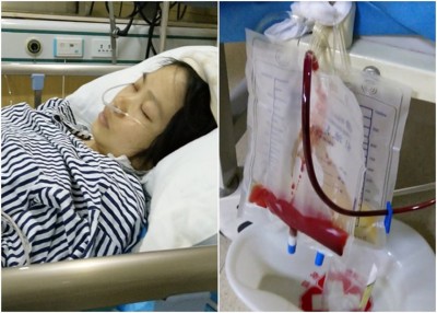 罗女上周四以医院诞子后,可以无掌握下于切掉子宫。