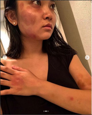 蒋劲夫对日本女友中浦悠花家暴。