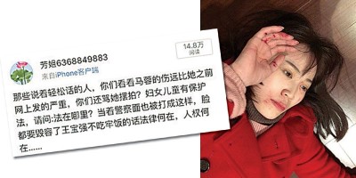 马蓉之前受伤照(右图)被酸摆拍,如今有挺她的网友爆她头破照为她发文叫屈。