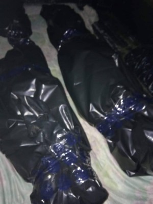 两名小死者的遗体,准备送往医院解剖。