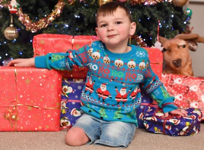 托尼4年前被亲生父母虐待，身体严重受伤。