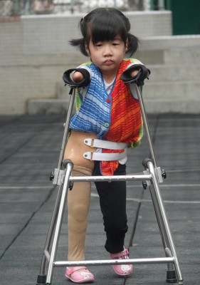 又立穿上义肢并用助行器行走。