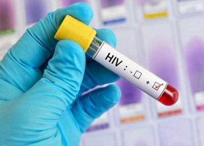 英国有自闭妇人被护理中心职员强奸，而感染爱滋病。