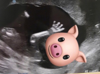 胡杏儿怀二胎，成功追到猪宝宝。