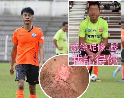 香港艺人李克勤来马进行友谊赛被踢伤后，在个人社交网站发泄不满。