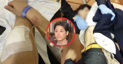 金男公开受伤照，控诉被打到断了3根肋骨，需要治疗5周。