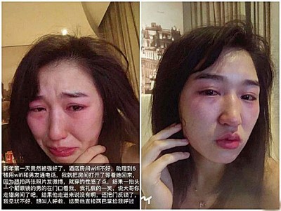 沈樵自爆在酒店被性侵 。