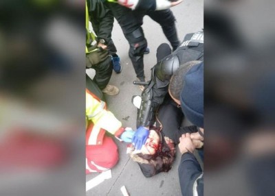 利尼耶被催泪弹击中，血流披面倒地。