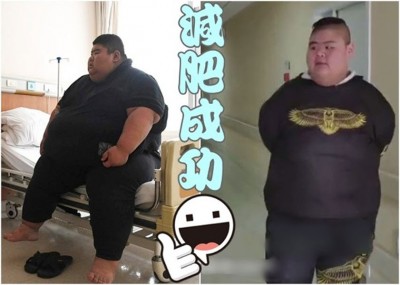 王浩楠原体重达334公斤，去年进行胃切除手术，半年后成功减至192公斤。