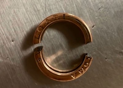 戒指最终被锯断。