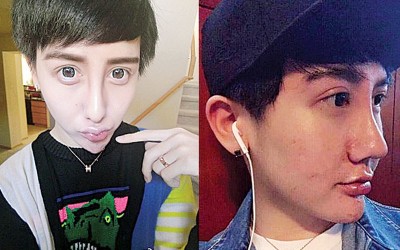 蛇精男再度进场维修，大方PO出术后素颜照片。