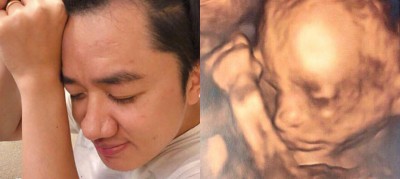 王祖蓝晒出女儿4D超声波照，许多网友表示鼻子和嘴巴和王祖蓝十分相似。