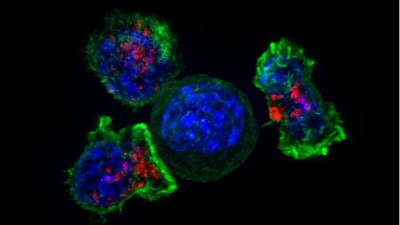 科学家发现杀手T细胞能有效对抗所有常见流感病毒。