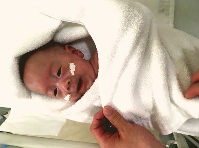“世界最小男婴”本月已经平安出院。（图源：日本庆应大学医院）