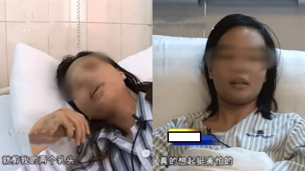73+ 图片 乳头 新的 25 被误认小三女子乳头被剪、下体遭刺! 光华日报| 1910年创刊创新每一天生活